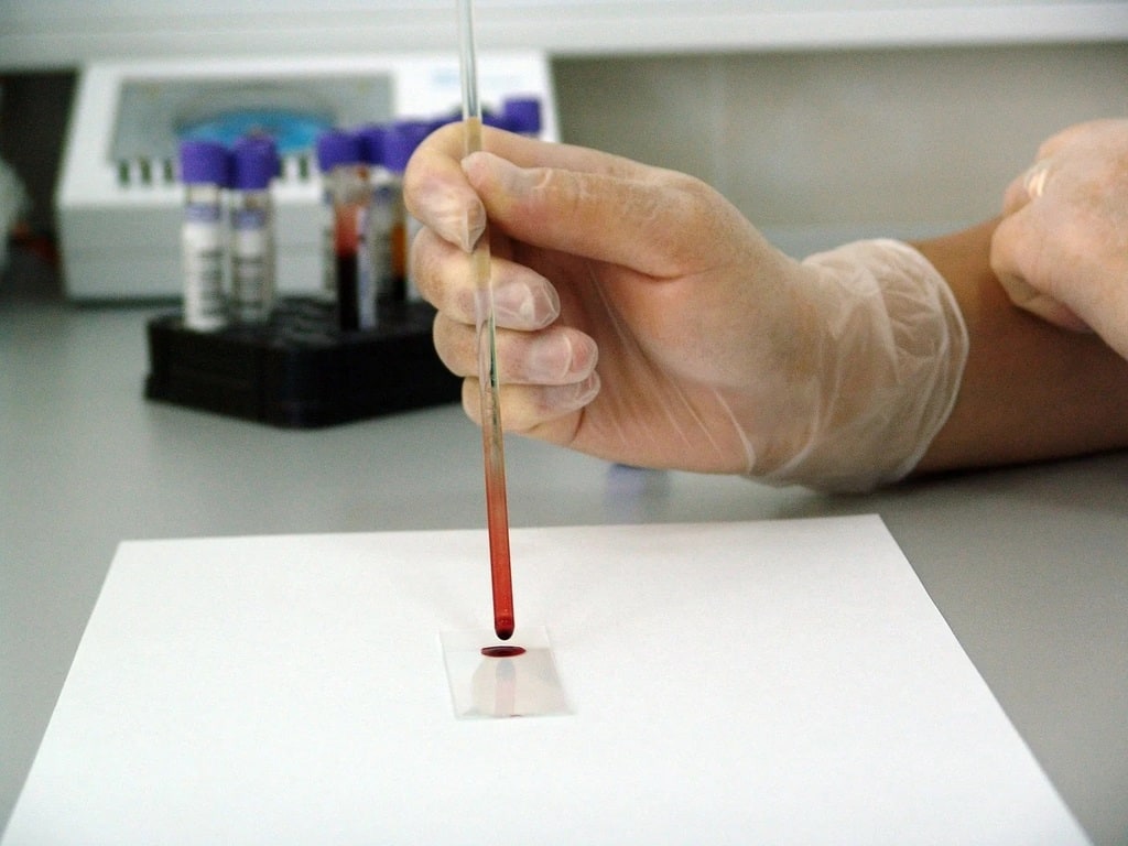 Superconductive metals defying temperature rules