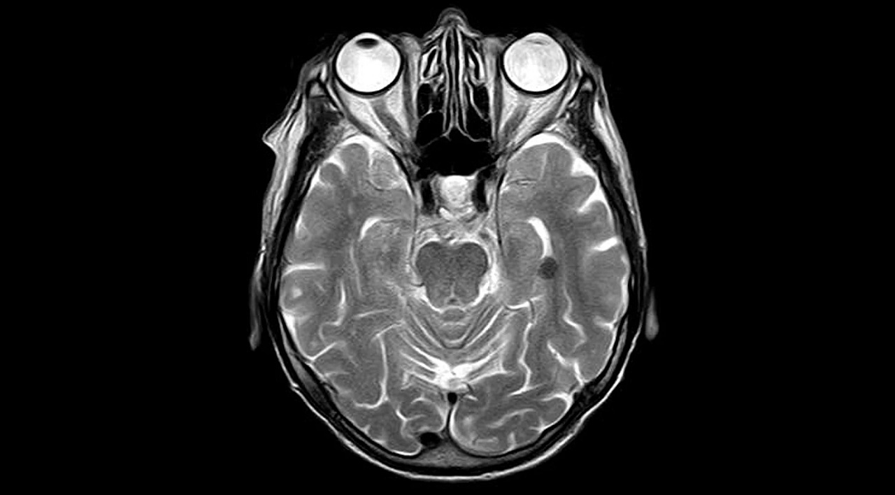 Synaptic plasticity altering behavioral paradigms